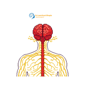 Nerve Decompression Surgery