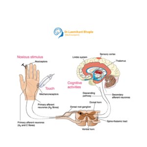 Neuropathic Pain Management