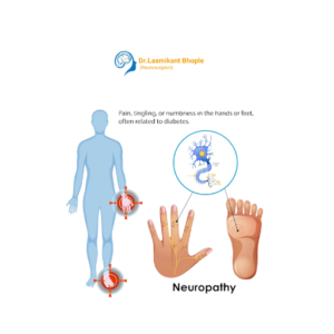 Peripheral Neuropathy Evaluation