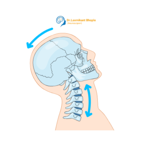 Head Injury & Trauma